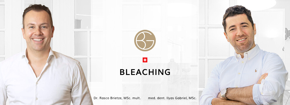 Bleaching, Zahnärzte Ebmatingen, Dr. Brietze & Dr. Gabriel 
