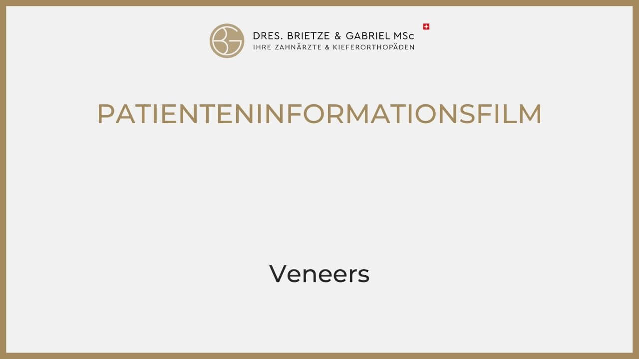 Veneers, Zahnärzte Ebmatingen, Dr. Brietze & Dr. Gabriel